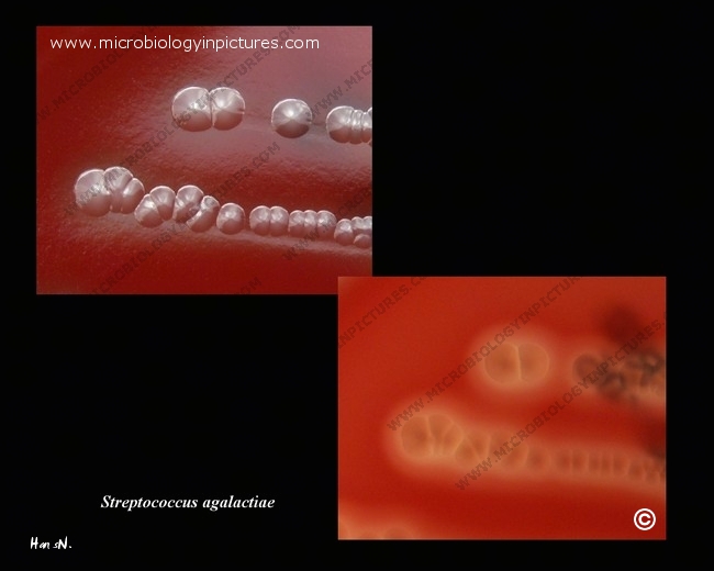 incomplete beta-hemolysis of s.agalactiae